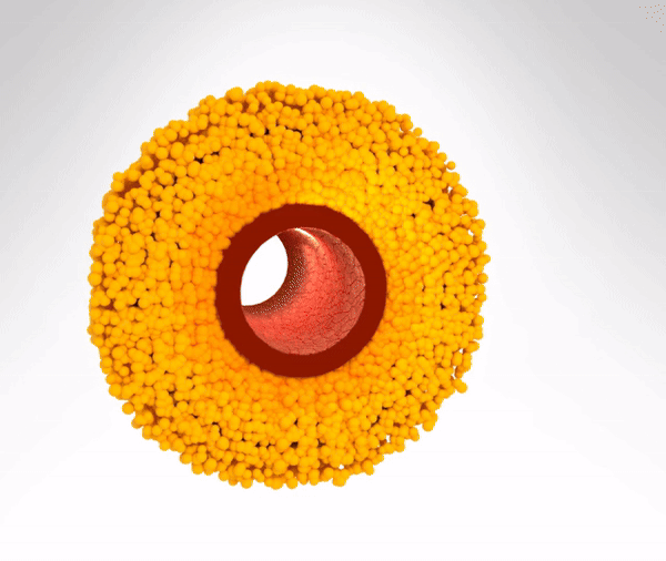 Φλεγμονώδης αρτηρία